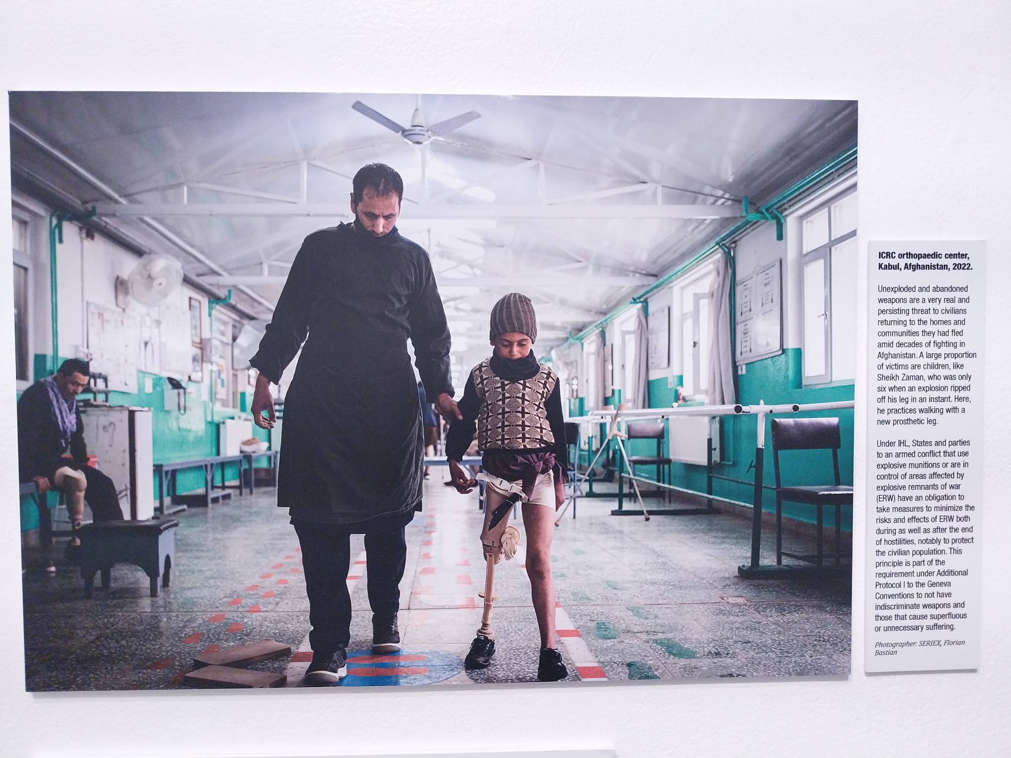 Image of a child with one leg in an orthopaedic center in Afghanistan. Photo by Elle Yap.